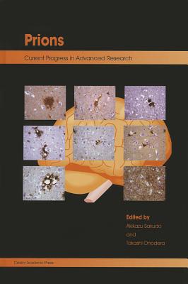 Prions: Current Progress in Advanced Research