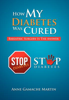 How My Diabetes Was Cured: Bariatric Surgery Is The Answer