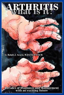 Arthritis what is it?: Decades of Diagnosis and Management with an exciting future