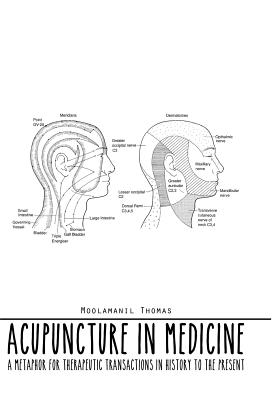 Acupuncture in Medicine: A Metaphor for Therapeutic Transactions in History to the Present