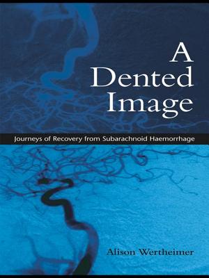 A Dented Image: Journeys of Recovery from Subarachnoid Haemorrhage