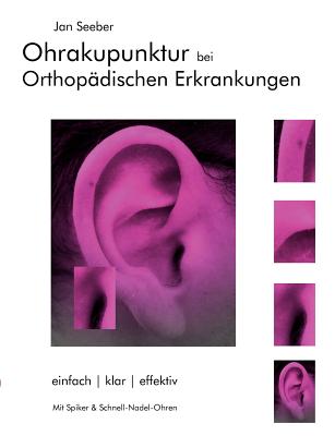 Ohrakupunktur bei Orthopädischen Erkrankungen: Balancierte Ohrakupunktur: einfach, klar, effektiv
