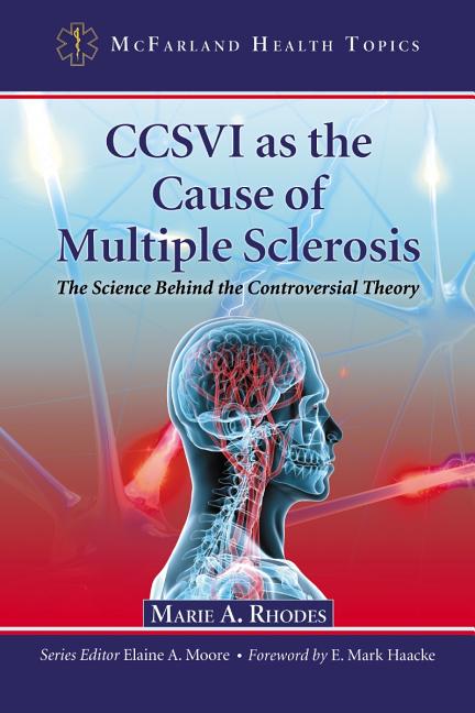 CCSVI as the Cause of Multiple Sclerosis: The Science Behind the Controversial Theory