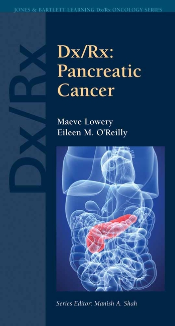 DX/Rx: Pancreatic Cancer: Pancreatic Cancer