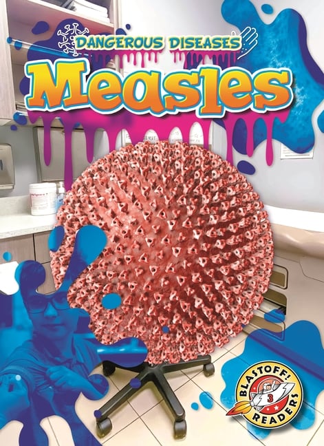 Measles