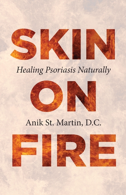 Skin on Fire: Healing Psoriasis Naturally