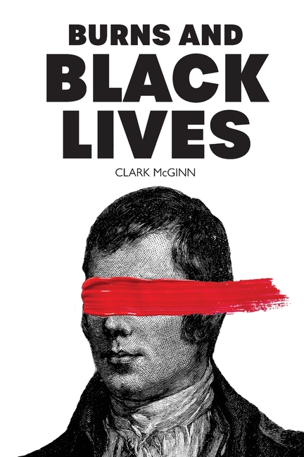 Burns and Black Lives