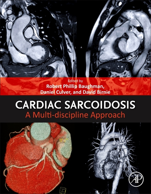 Cardiac Sarcoidosis: A Multi-Discipline Approach
