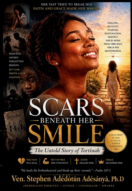 Scars Beneath Her Smile: The Untold Story Of Tortinah