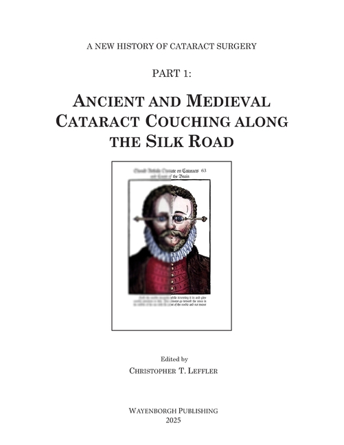 Ancient and Medieval Cataract Couching along the Silk Road