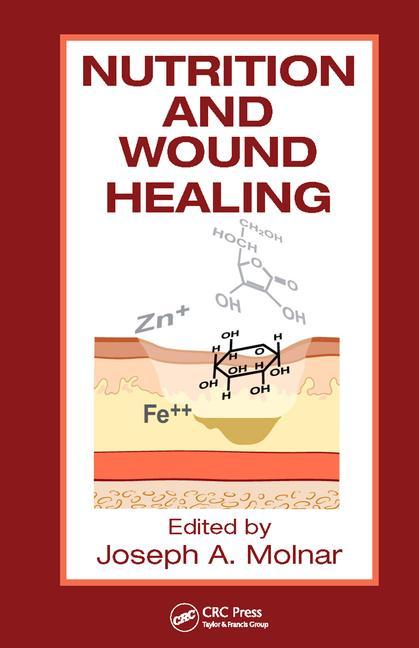 Nutrition and Wound Healing