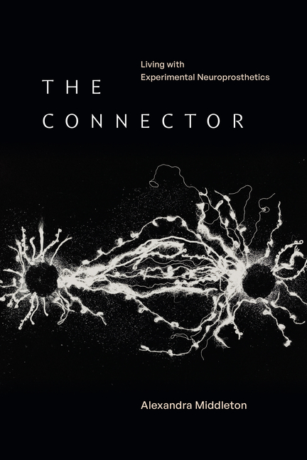 The Connector: Living with Experimental Neuroprosthetics