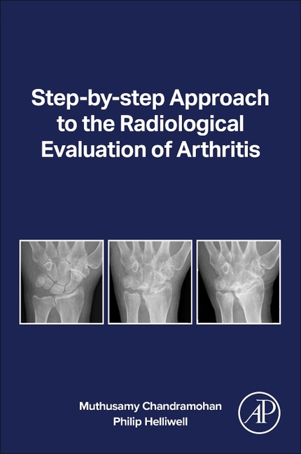 Step-By-Step Approach to the Radiological Evaluation of Arthritis