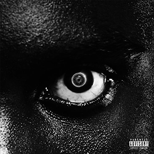Lithopedion